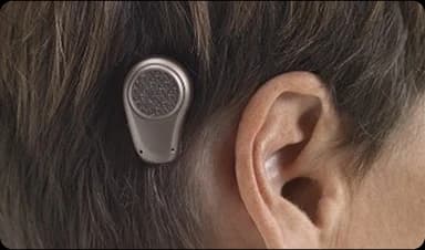 Bone Conduction Hearing Aids