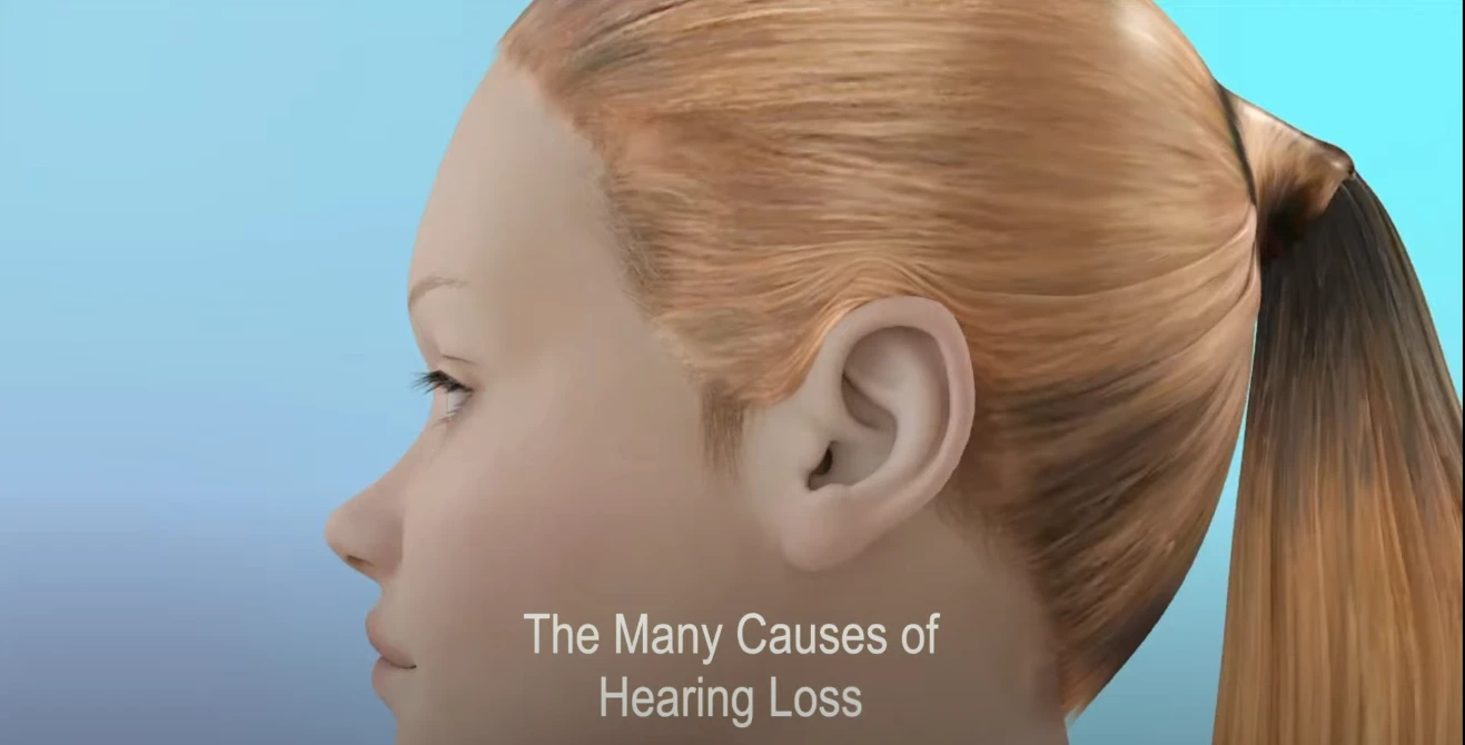 HearingTestImage