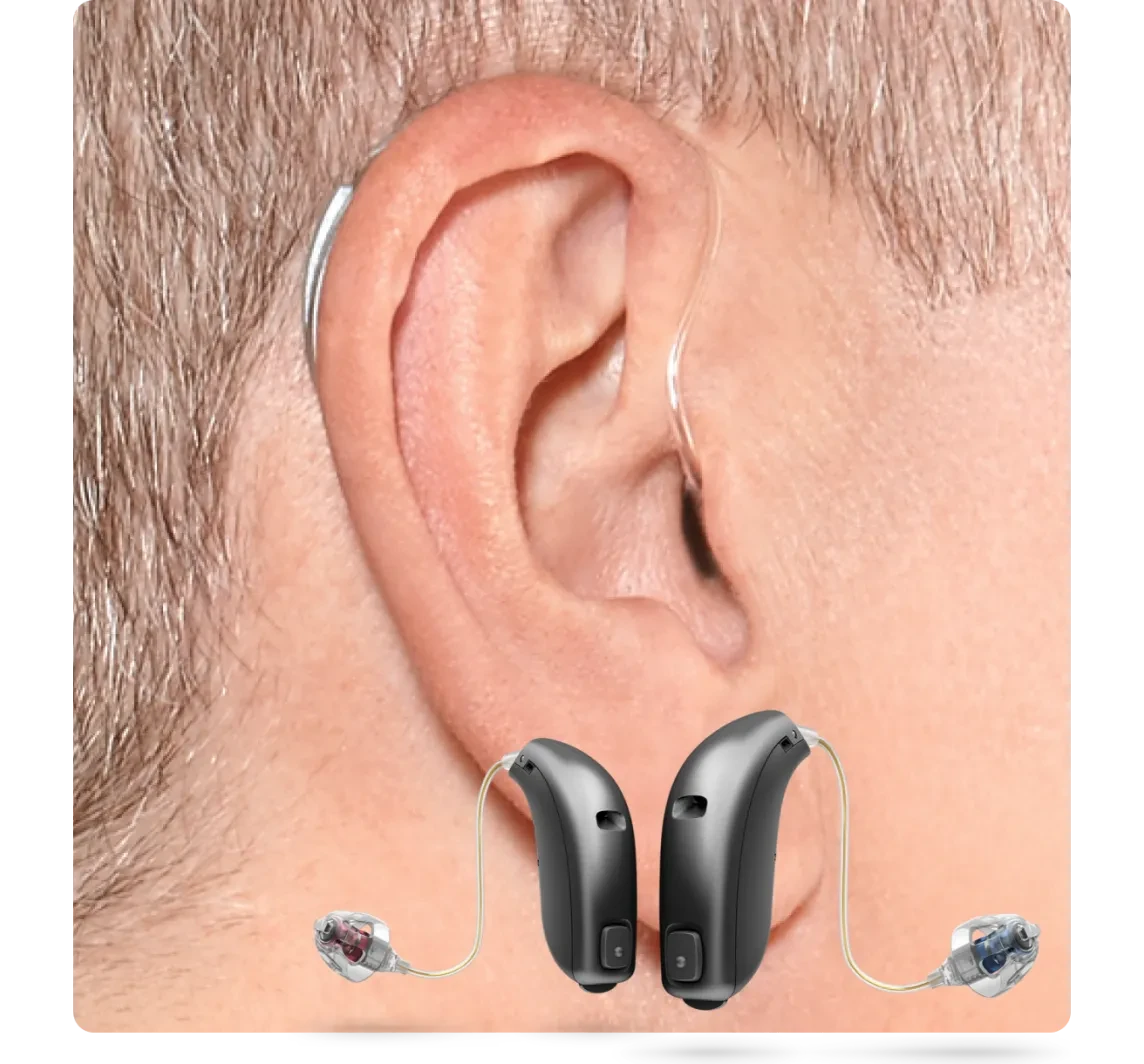 What is a RITE Hearing Aid?